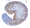 Embrioid test, Ki-67 immun-hisztokémiai reakció. A sejtciklusban (G1, S, G2 és M fázis) lévő sejtek magja barna színreakciót mutat, a nyugvó (G0 fázis) sejteké kék. Fotó: 